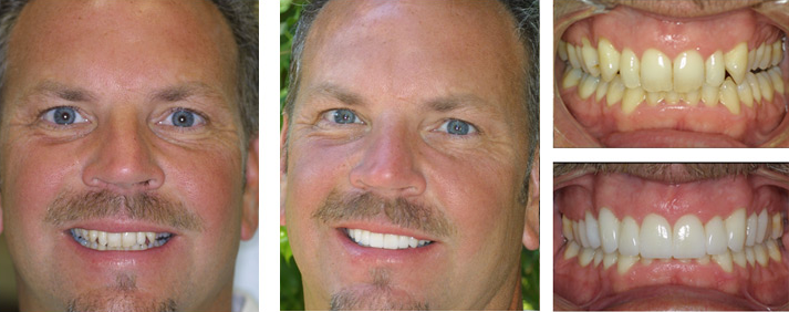 Third Coast Dental Before and After
