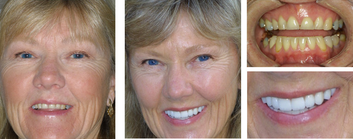 Third Coast Dental Before and After